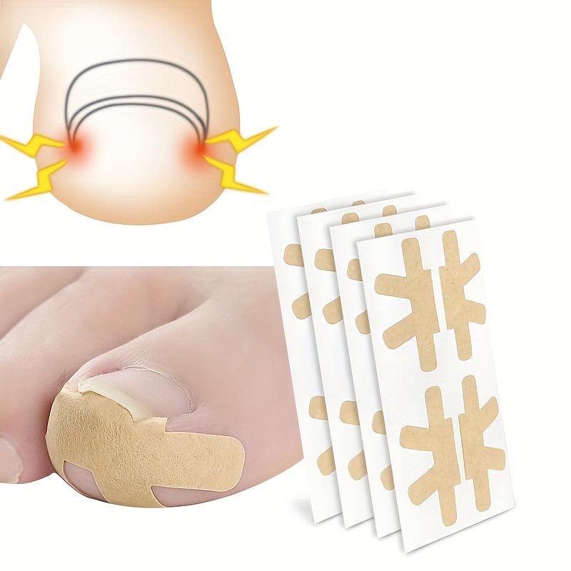Ingrown Toenail Correction Stickers 80PCS