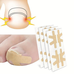 Ingrown Toenail Correction Stickers 80PCS