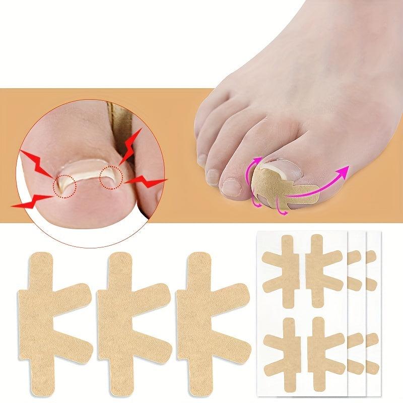 Ingrown Toenail Correction Stickers 80PCS