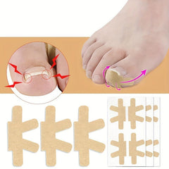 Ingrown Toenail Correction Stickers 80PCS