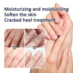 Deeply Nourishing Hand Cream for Cracked Skin