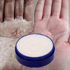 Deeply Nourishing Hand Cream for Cracked Skin