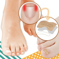 10 Pcs Ingrown Toenail Correction Sticker Glueless Corrector Strip Foot Care