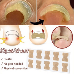 10 Pcs Ingrown Toenail Correction Sticker Glueless Corrector Strip Foot Care