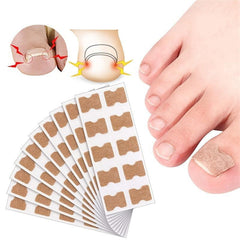 10 Pcs Ingrown Toenail Correction Sticker Glueless Corrector Strip Foot Care