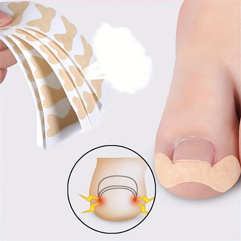12 Pcs Beige Nail Straightening Stickers Elastic Adhesive Tape Brace Stick