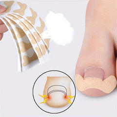 12 Pcs Beige Nail Straightening Stickers Elastic Adhesive Tape Brace Stick