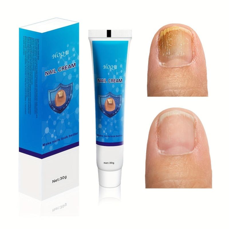 Toenail Moisturizing Care Thickening Nail Foot Spa