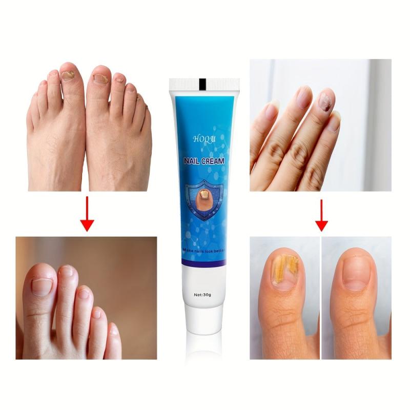 Toenail Moisturizing Care Thickening Nail Foot Spa