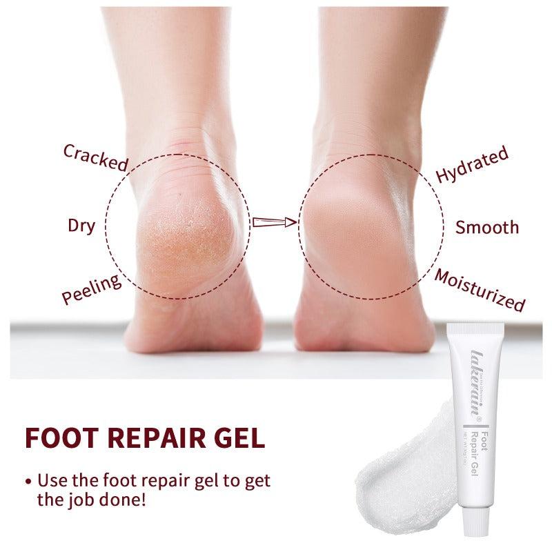 Moisturizing Foot Heel Cream Repair Gel for Dry Rough Hands