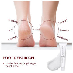 Moisturizing Foot Heel Cream Repair Gel for Dry Rough Hands