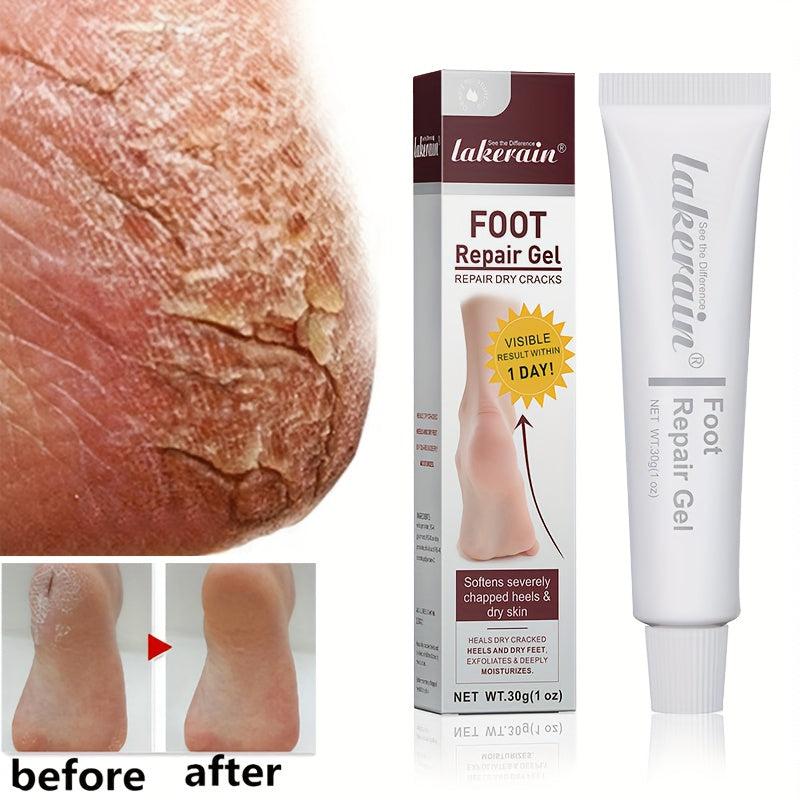 Moisturizing Foot Heel Cream Repair Gel for Dry Rough Hands