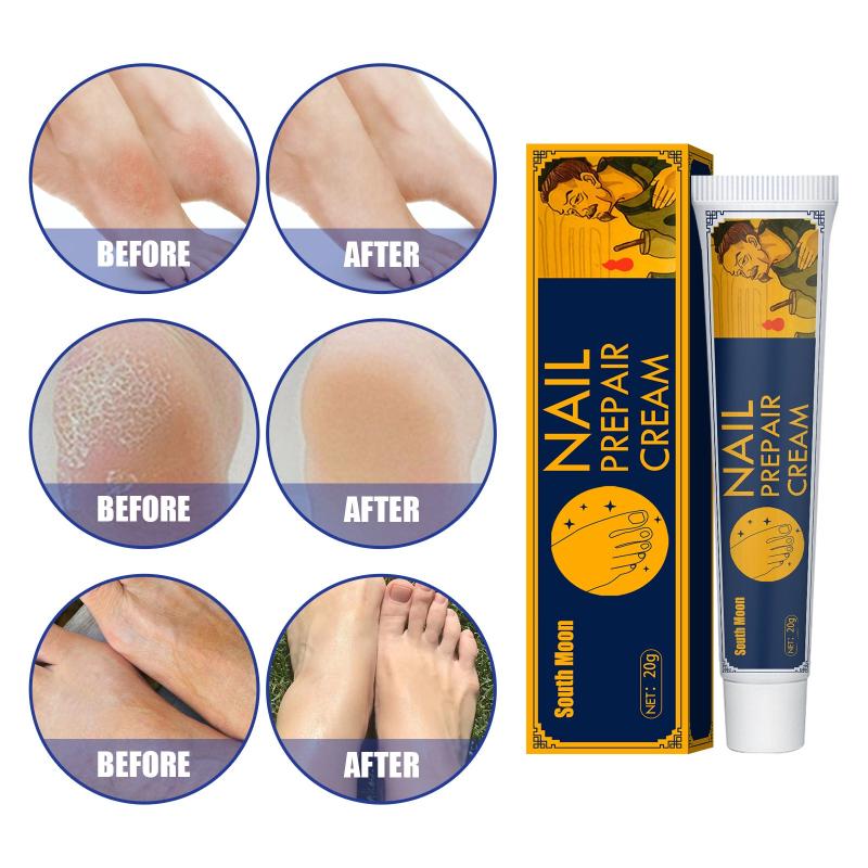 Foot Nourishing Cream Prevents Dryness and Cracks in Winter Moisturizes Skin 20g