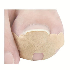 Ingrown Toenail Correction Stickers 40PCS Paronychia Toe Nail Healing