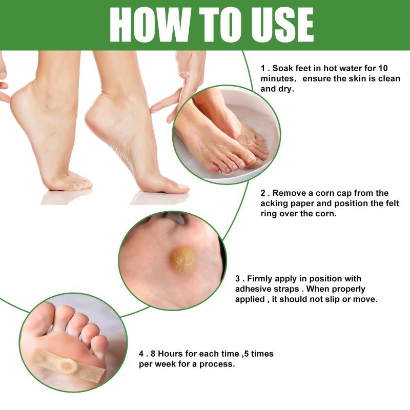 30 Pcs Foot Corn Clean Pads - Naturally Clean Toe Corns And Calluses