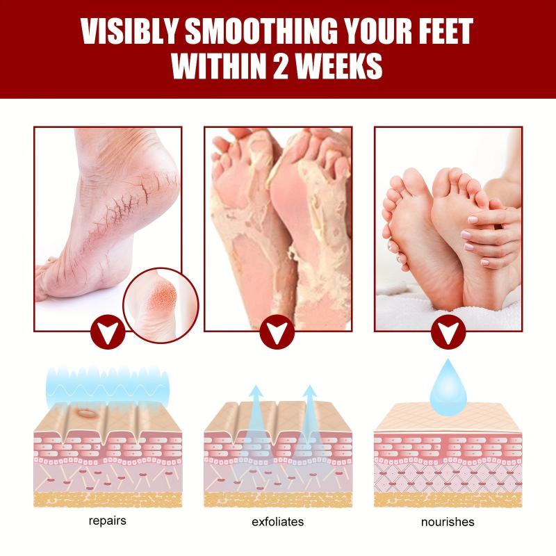 5pcs Fruit Acid Exfoliating Foot Mask - Hydrating and Moisturizing