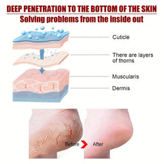 5pcs Fruit Acid Exfoliating Foot Mask - Hydrating and Moisturizing