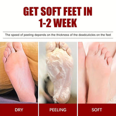 5pcs Fruit Acid Exfoliating Foot Mask - Hydrating and Moisturizing