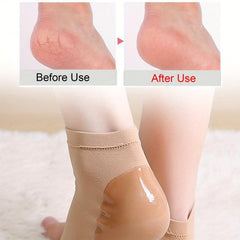 Moisturizing Heel Protector Sleeve - Plantar Fasciitis Care Pad