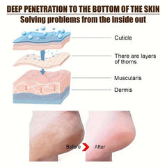 Vitamin C Foot Cream for Dry Cracked Heel - Moisturizing Foot Care