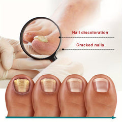 32pcs Nail Care Patch For Brittle And Thick Nails Brightening Your Nails