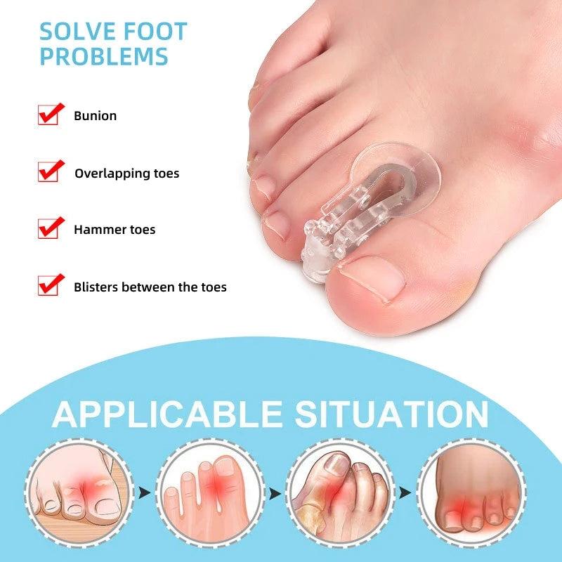 Silicone Toe Separators for Overlapping Toes - Toe Stretcher Divider Guards