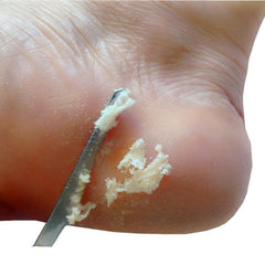 Stainless Steel Pedicure Scraper for Dead Skin Removal