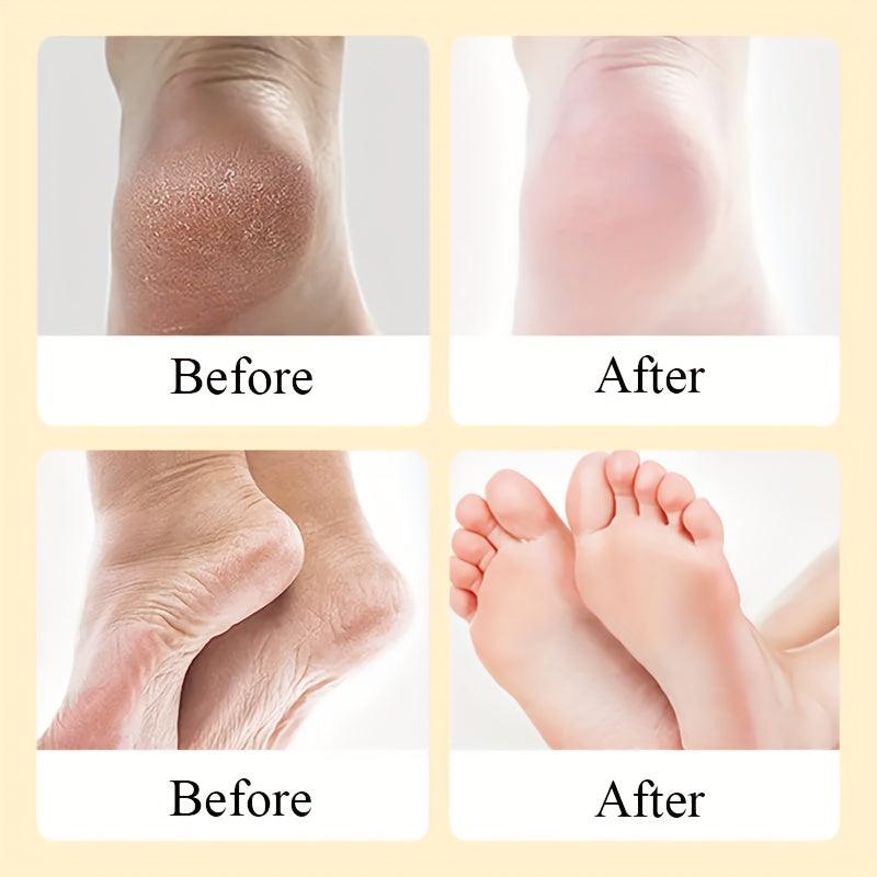 Foot Exfoliating Cream Dead Skin Remover Repairing Dry Cracked Skin