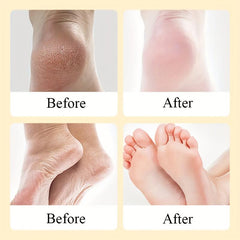 Foot Exfoliating Cream Dead Skin Remover Repairing Dry Cracked Skin