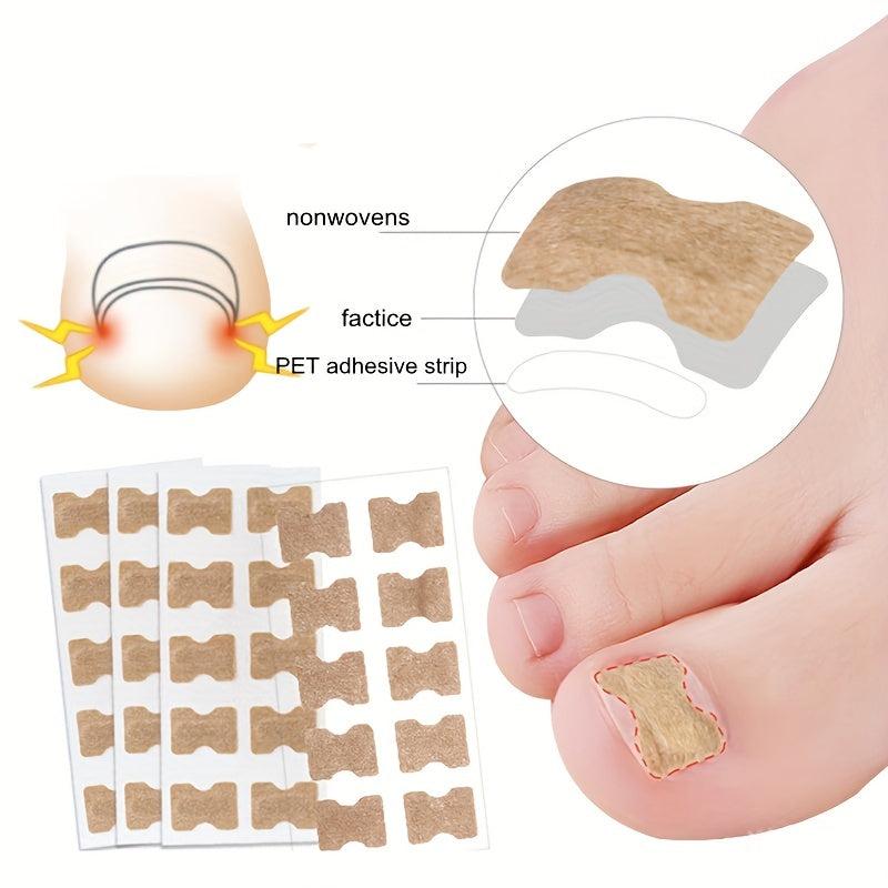 10pcs Ingrown Toenail Correction Strips Painless Pedicure Patch
