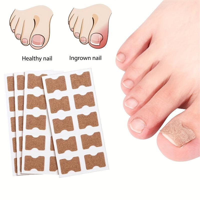 10pcs Ingrown Toenail Correction Strips Painless Pedicure Patch
