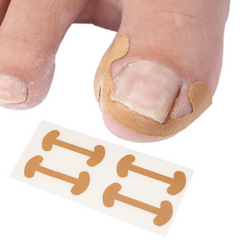 20pcs Ingrown Toenail Corrector Stickers Toe Nail Care Pedicure Tools