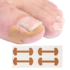 20pcs Ingrown Toenail Corrector Stickers Toe Nail Care Pedicure Tools