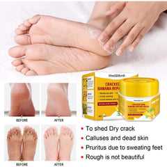 Banana Foot Cream Nourishing & Softening Dead Skin 30g