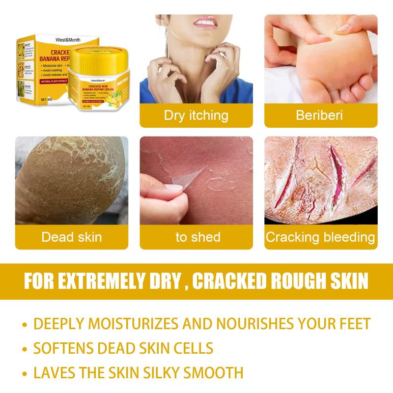 Banana Foot Cream Nourishing & Softening Dead Skin 30g