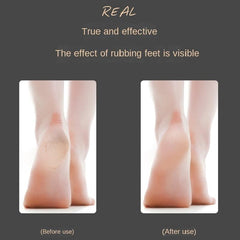 Pumice Stone Callus Remover Foot Scrubber Exfoliator
