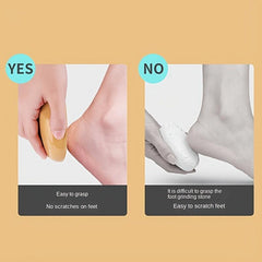 Pumice Stone Callus Remover Foot Scrubber Exfoliator