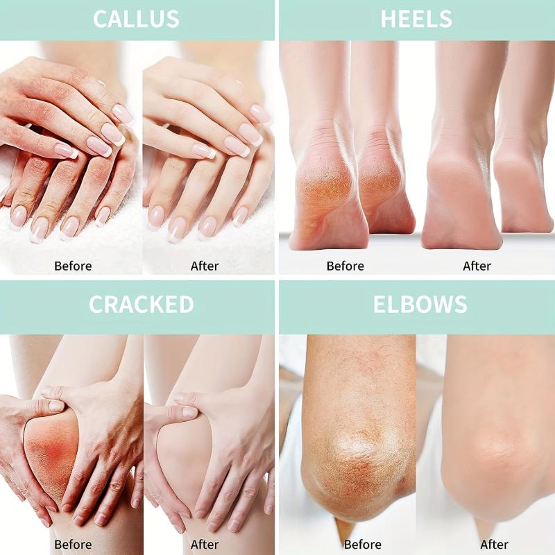 76oz Foot Cream For Dry Cracked Heel Foot Massage Cream Moisturizing Cream