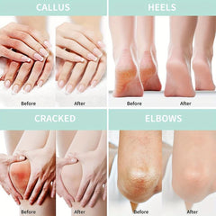 76oz Foot Cream For Dry Cracked Heel Foot Massage Cream Moisturizing Cream