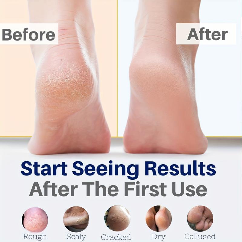 76oz Foot Cream For Dry Cracked Heel Foot Massage Cream Moisturizing Cream