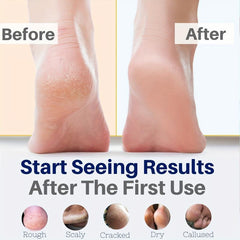 76oz Foot Cream For Dry Cracked Heel Foot Massage Cream Moisturizing Cream
