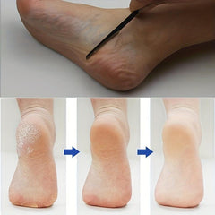 Stainless Steel Pedicure Tool Set for Ingrown Toe Nail Correction