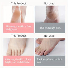 Urea Foot Cream for Dry Rough Cracked Skin - Moisturize and Nourish Your Feet