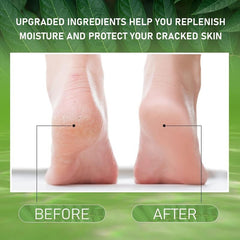 Rose Foot Cream Moisturizing Softens Rough Cracked Feet