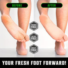 Rose Foot Cream Moisturizing Softens Rough Cracked Feet