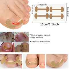 Ingrown Toenail Corrector Sticker Nail Strip Anti Roll Nail Glue Toe Inlay