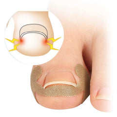 Ingrown Toenail Corrector Sticker Nail Strip Anti Roll Nail Glue Toe Inlay