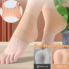 Moisturizing Gel Heel Socks - Open Toe Socks For Dry Hard Cracked Heels
