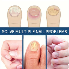 Nail Strengthener Cream for Smooth Nail Care