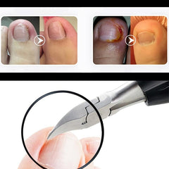Ingrown Nail Clippers Manicure Pedicure Tool Set Nail Care